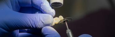 A dentist works on dentures
