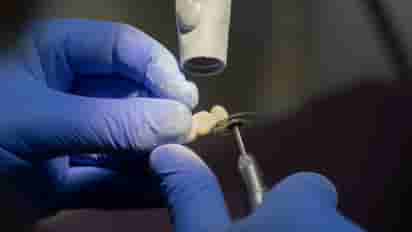 A dentist works on dentures